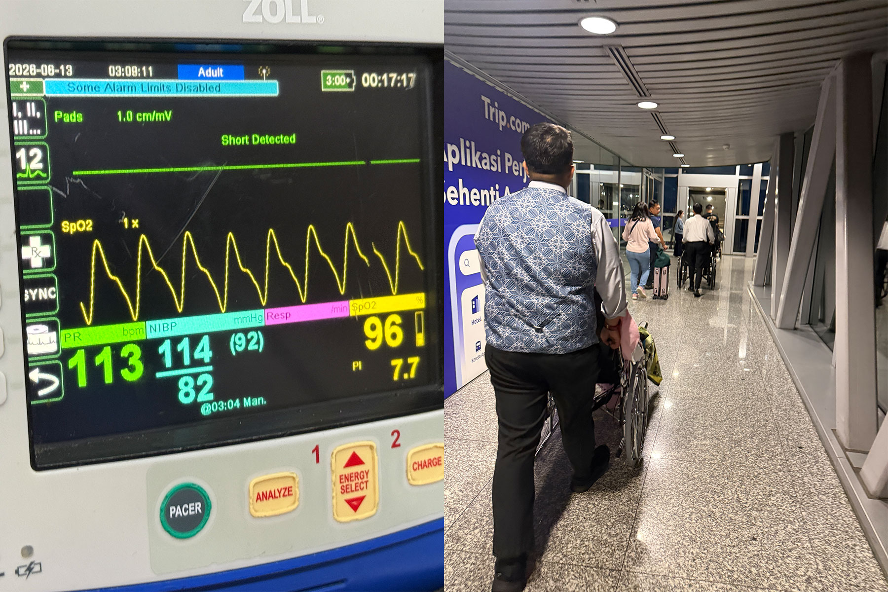 Nurse escort preparing the patient for commercial travel